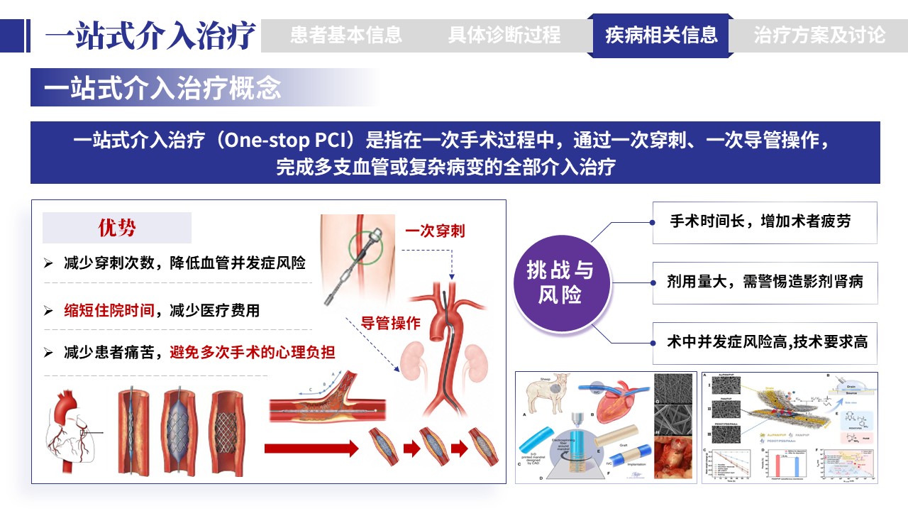401期-病例汇报-一例多支冠脉病变一站式介入治疗病例汇报第12页预览