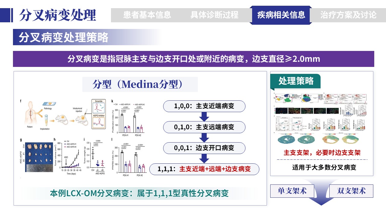 401期-病例汇报-一例多支冠脉病变一站式介入治疗病例汇报第13页预览