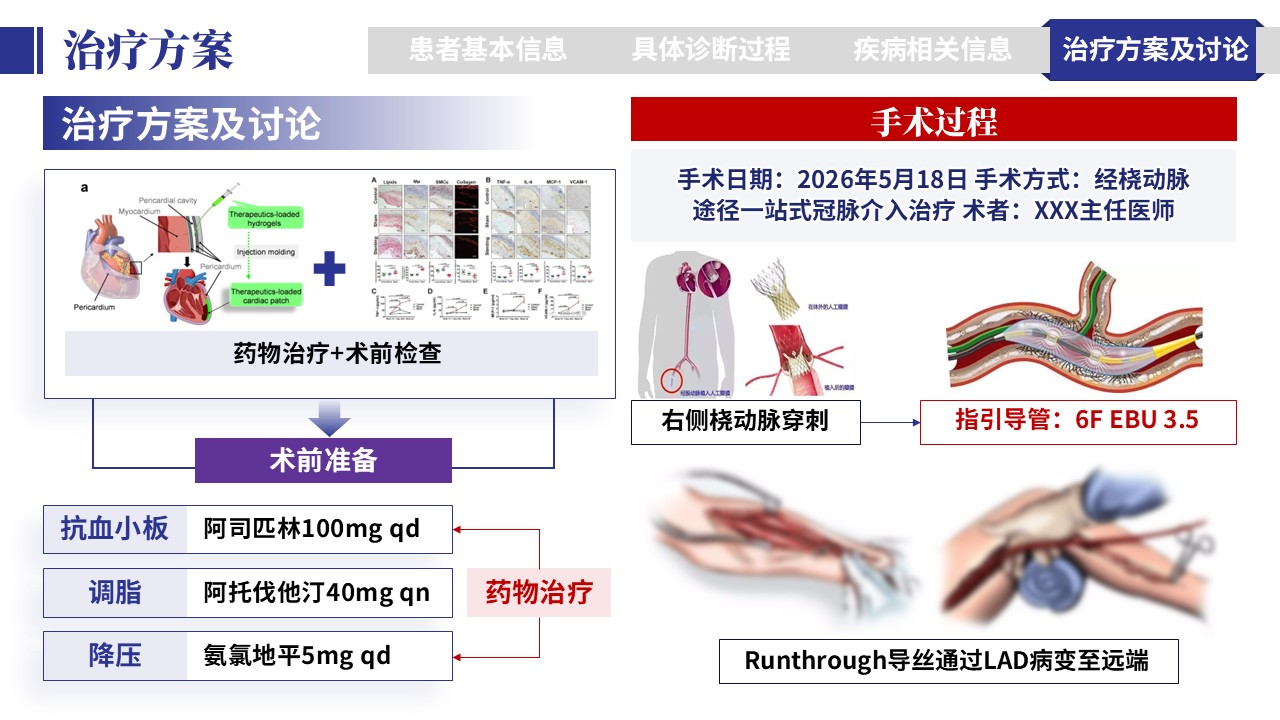 401期-病例汇报-一例多支冠脉病变一站式介入治疗病例汇报第15页预览