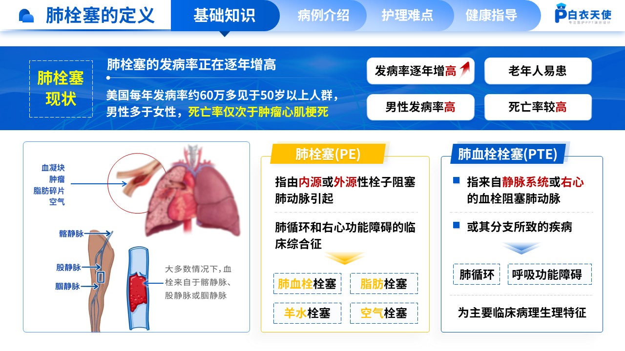 163期-肺栓塞疑难病例讨论第3页预览