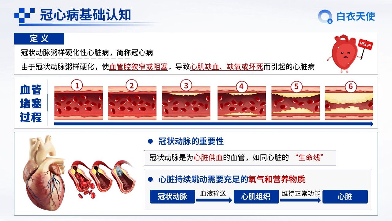 09-冠心病健康宣教第3页预览