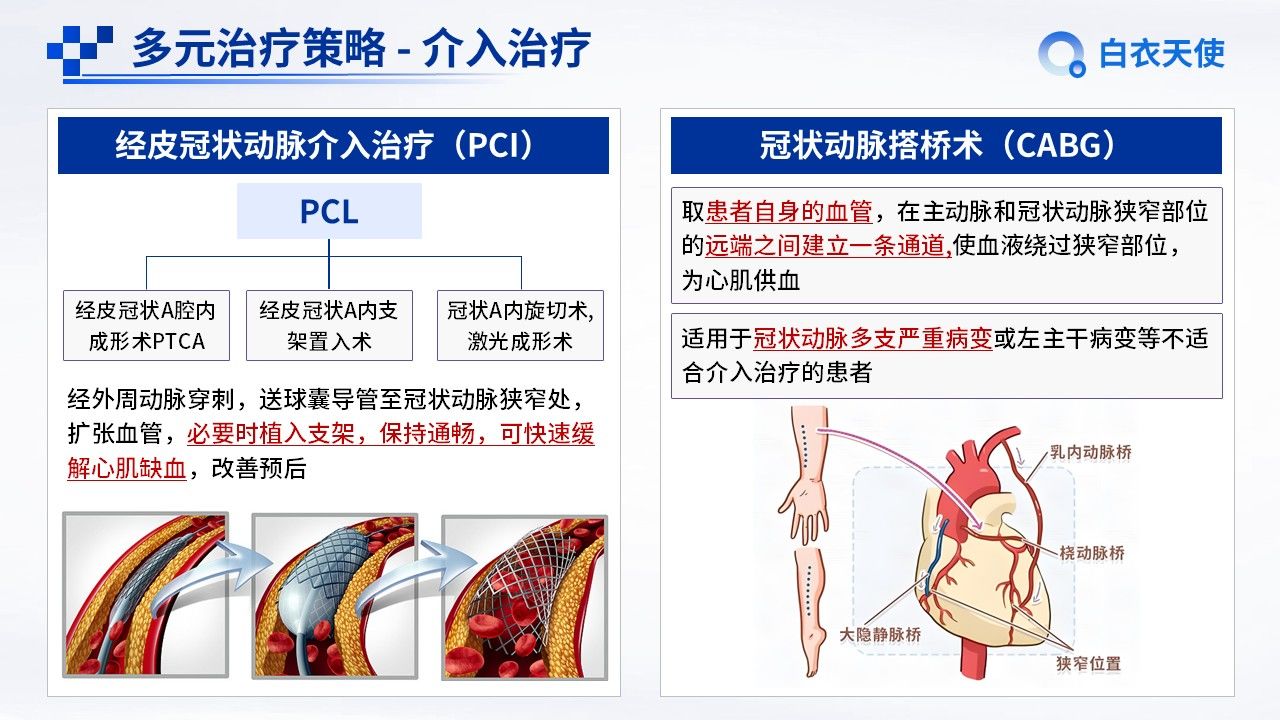 09-冠心病健康宣教第9页预览