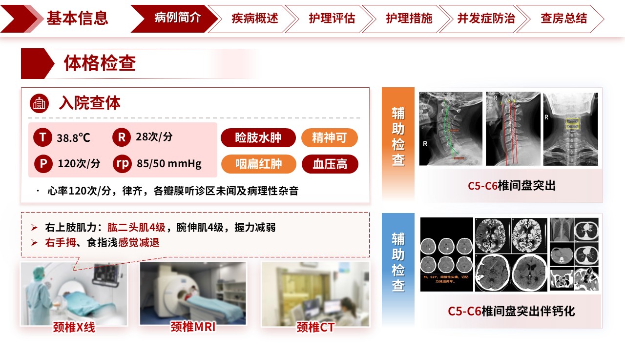 326期-护理查房-科学防治颈椎病，提升临床护理能力——专科护理教学查房第4页预览