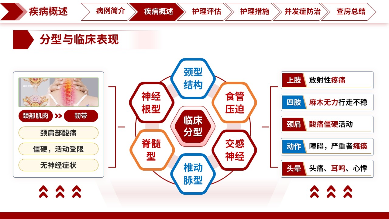 326期-护理查房-科学防治颈椎病，提升临床护理能力——专科护理教学查房第8页预览