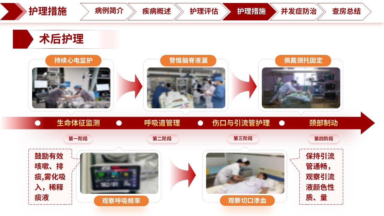 326期-护理查房-科学防治颈椎病，提升临床护理能力——专科护理教学查房第16页预览