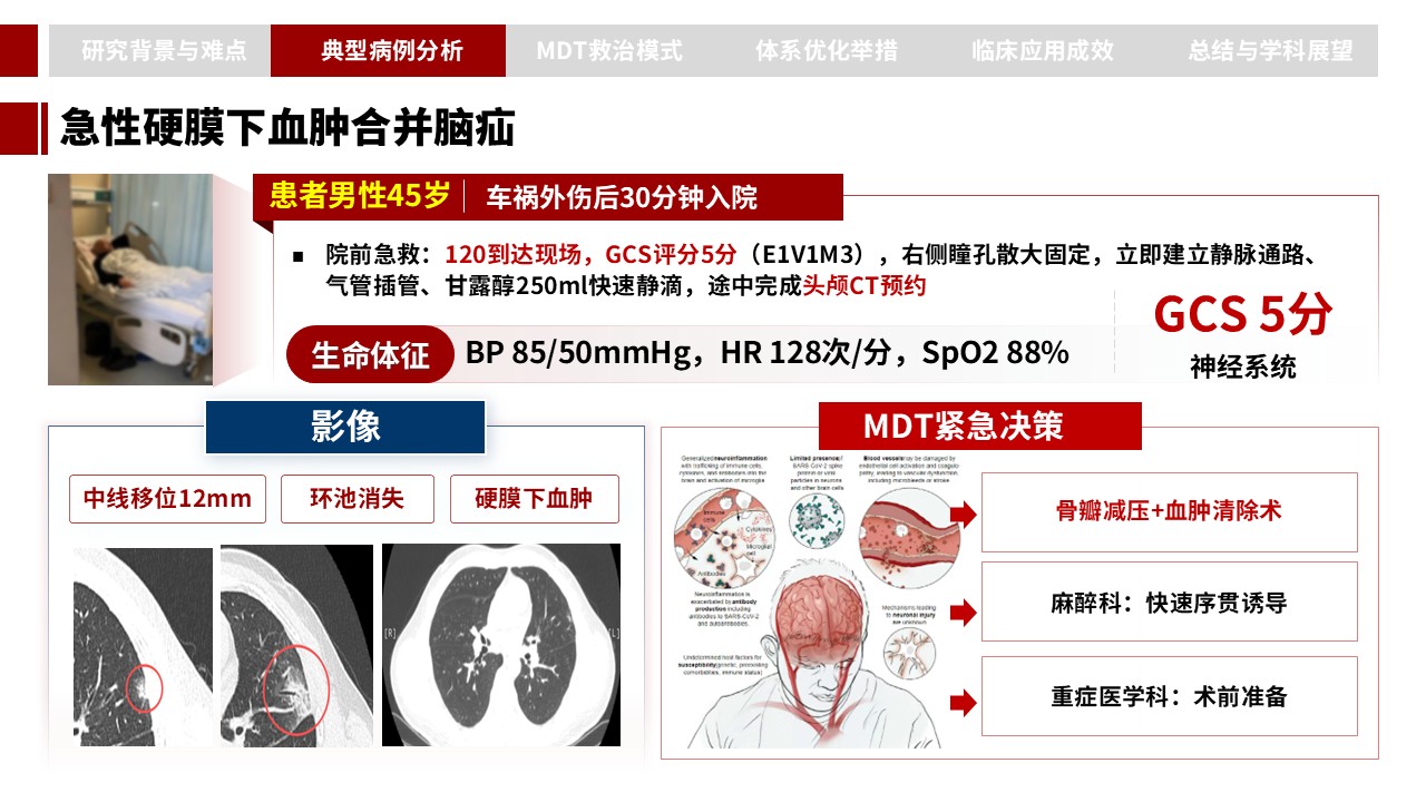394期-申报答辩-重型颅脑损伤 MDT 一体化救治病例汇报与诊疗体系优化第7页预览