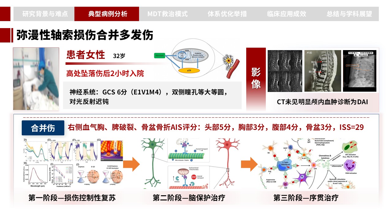 394期-申报答辩-重型颅脑损伤 MDT 一体化救治病例汇报与诊疗体系优化第8页预览