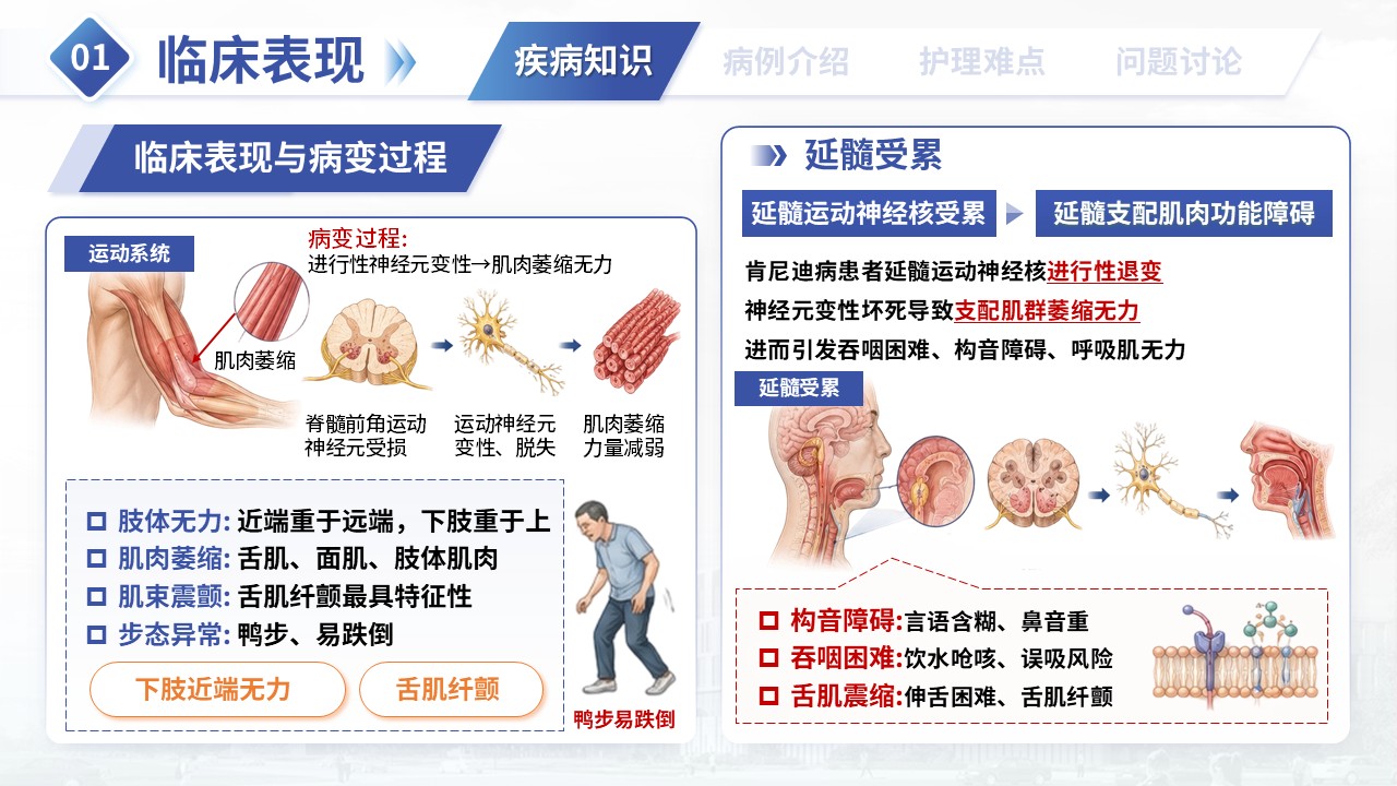 381期-疑难病例讨论-肯尼迪病患者运动功能康复护理第4页预览