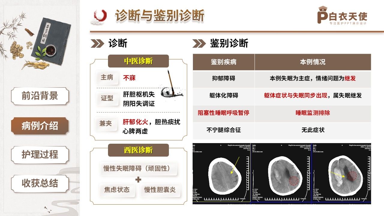 423期-疑难病例讨论-一例肝胆枢机失和阴阳失调顽固性慢性失眠的中医调治疑难讨论第9页预览