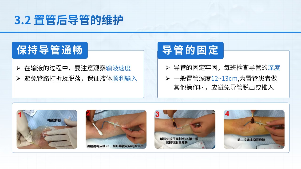 25-中心静脉置管护理第10页预览
