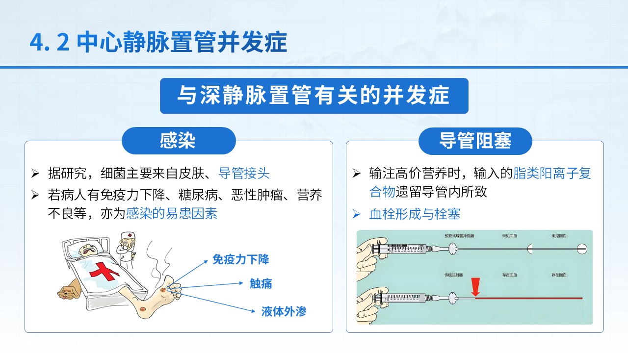 25-中心静脉置管护理第15页预览