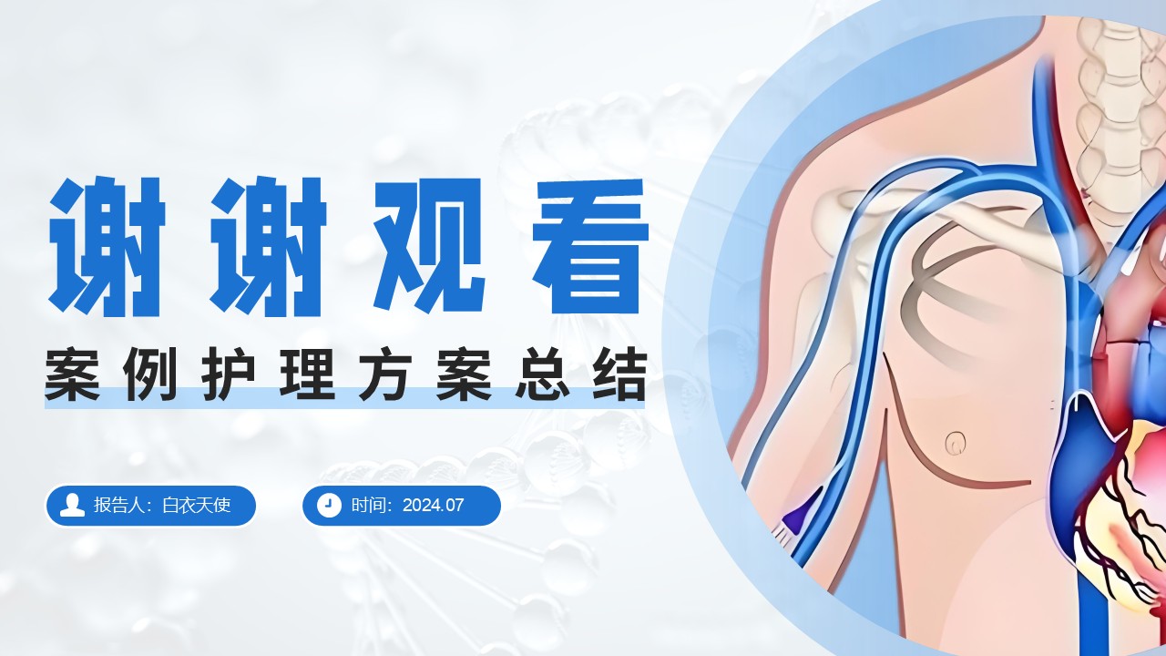25-中心静脉置管护理第20页预览