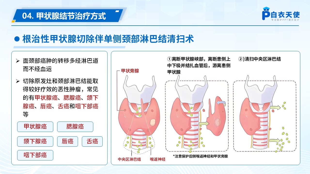 69-甲状腺结节健康宣教第9页预览