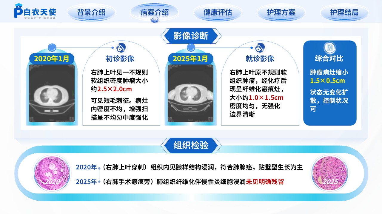216期-个案护理第6页预览