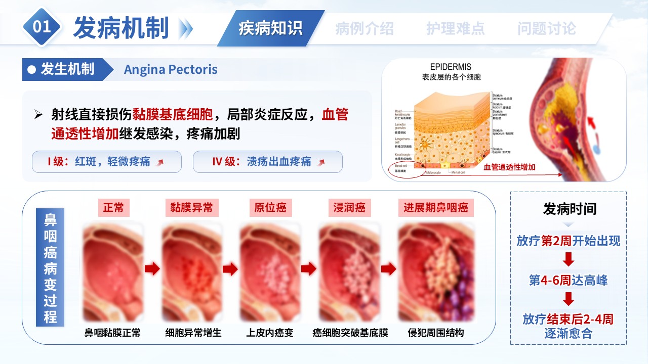 第364期-护理疑难病例讨论-一例鼻咽癌患者根治性放疗护理第4页预览