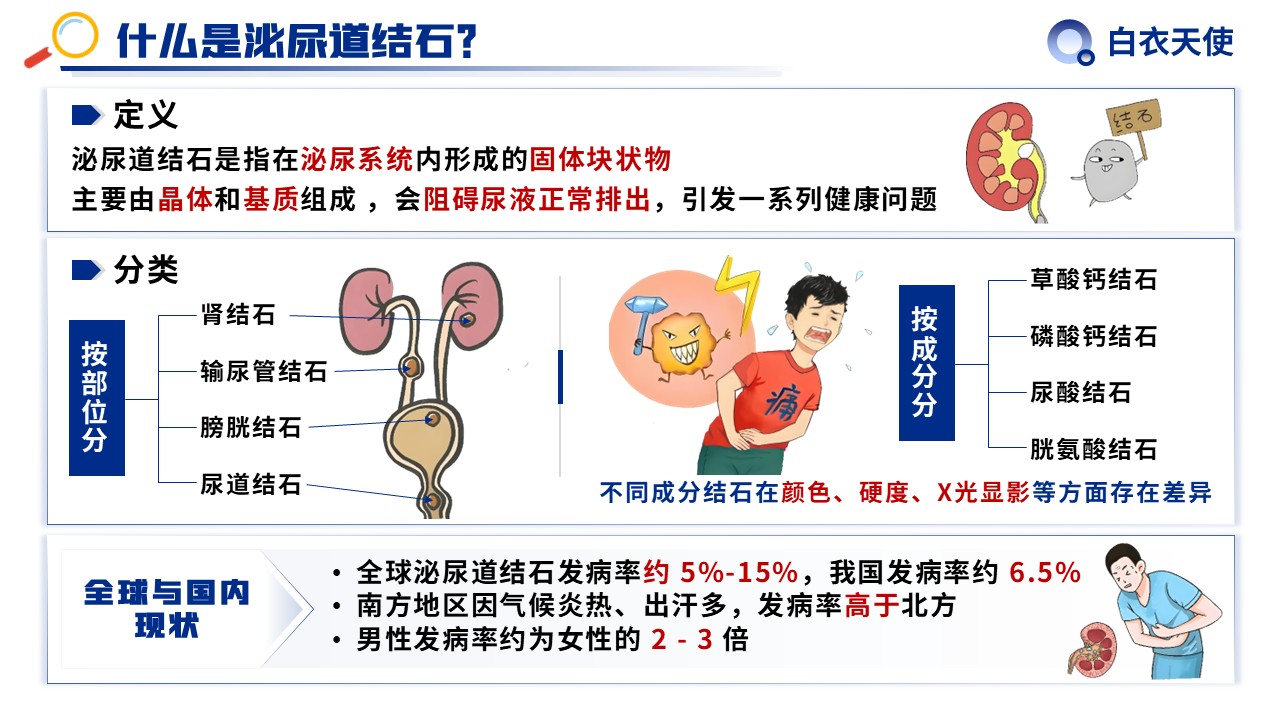 31-泌尿道结石健康宣教第3页预览