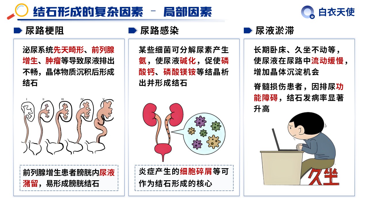 31-泌尿道结石健康宣教第5页预览