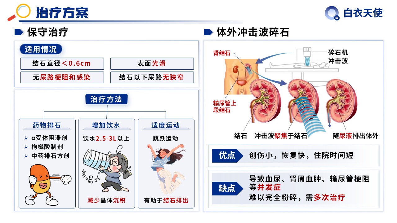 31-泌尿道结石健康宣教第11页预览