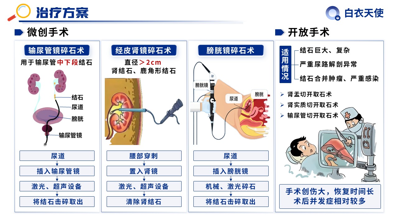 31-泌尿道结石健康宣教第12页预览