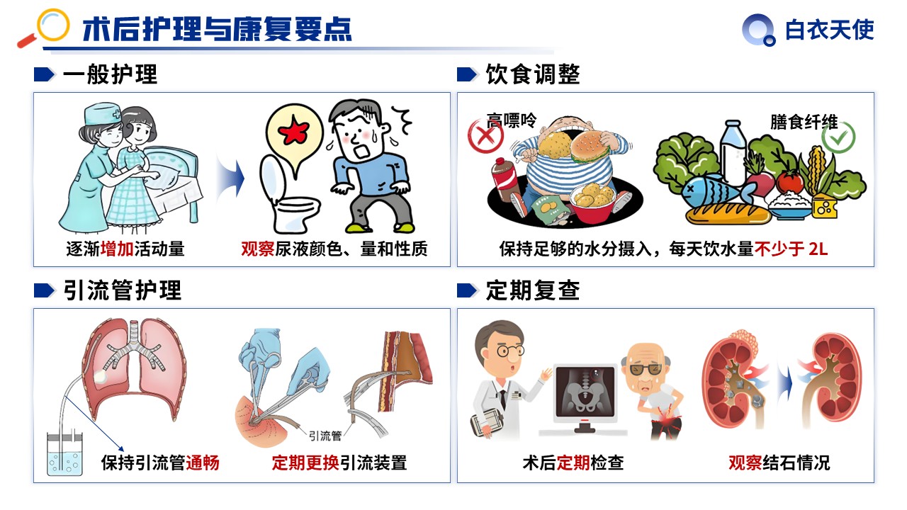 31-泌尿道结石健康宣教第13页预览