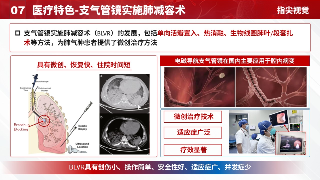 025期-呼吸内科科室主任述职答辩（红色）第9页预览