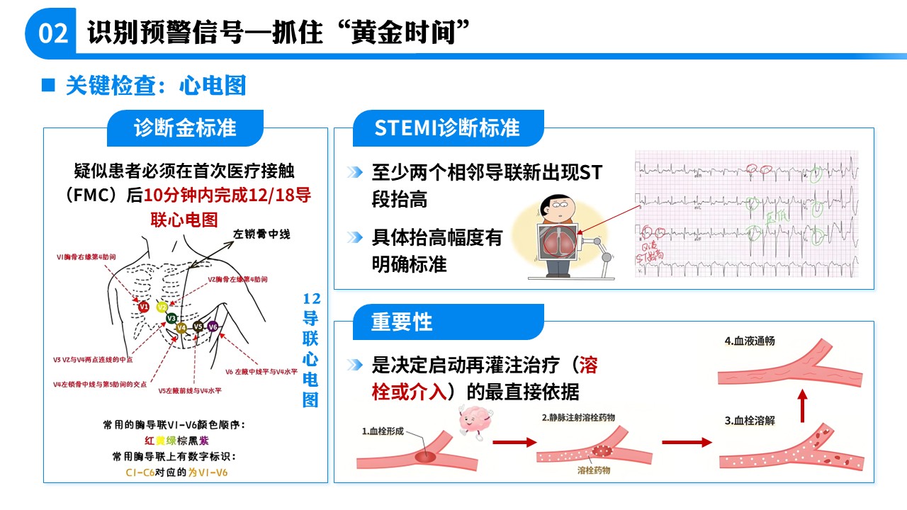 71-急性心肌梗死急救科普第6页预览