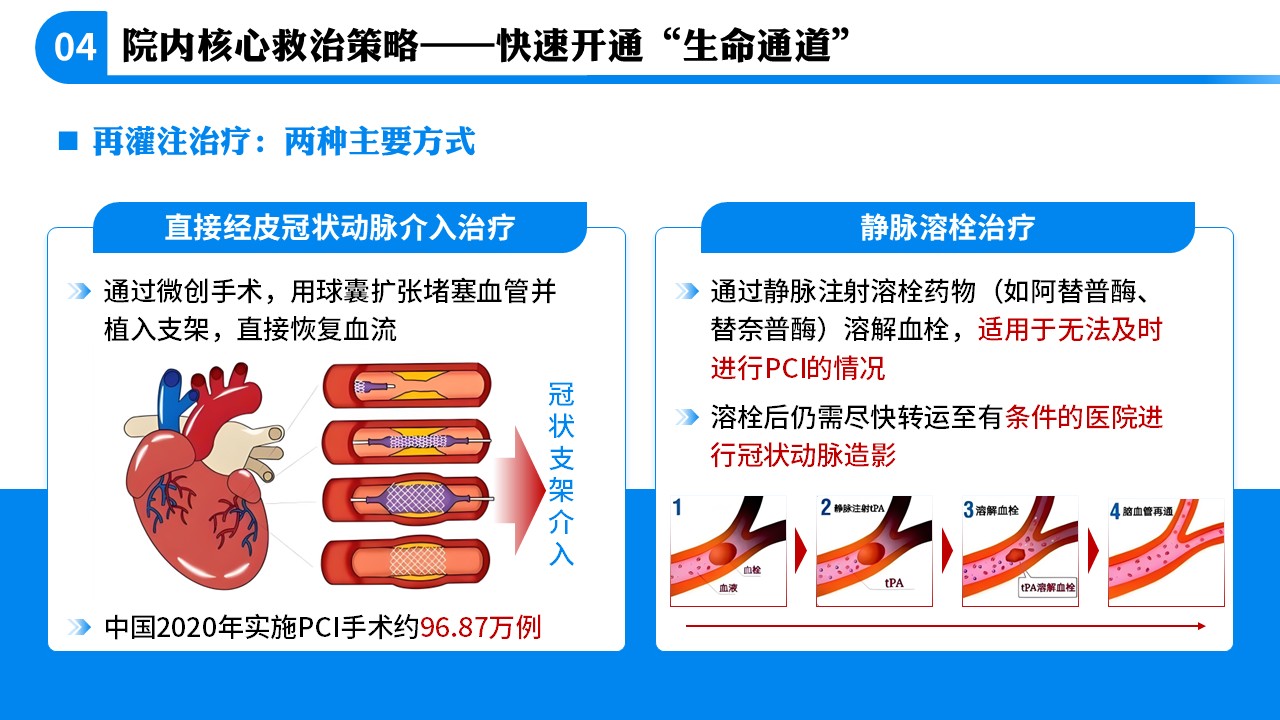 71-急性心肌梗死急救科普第10页预览