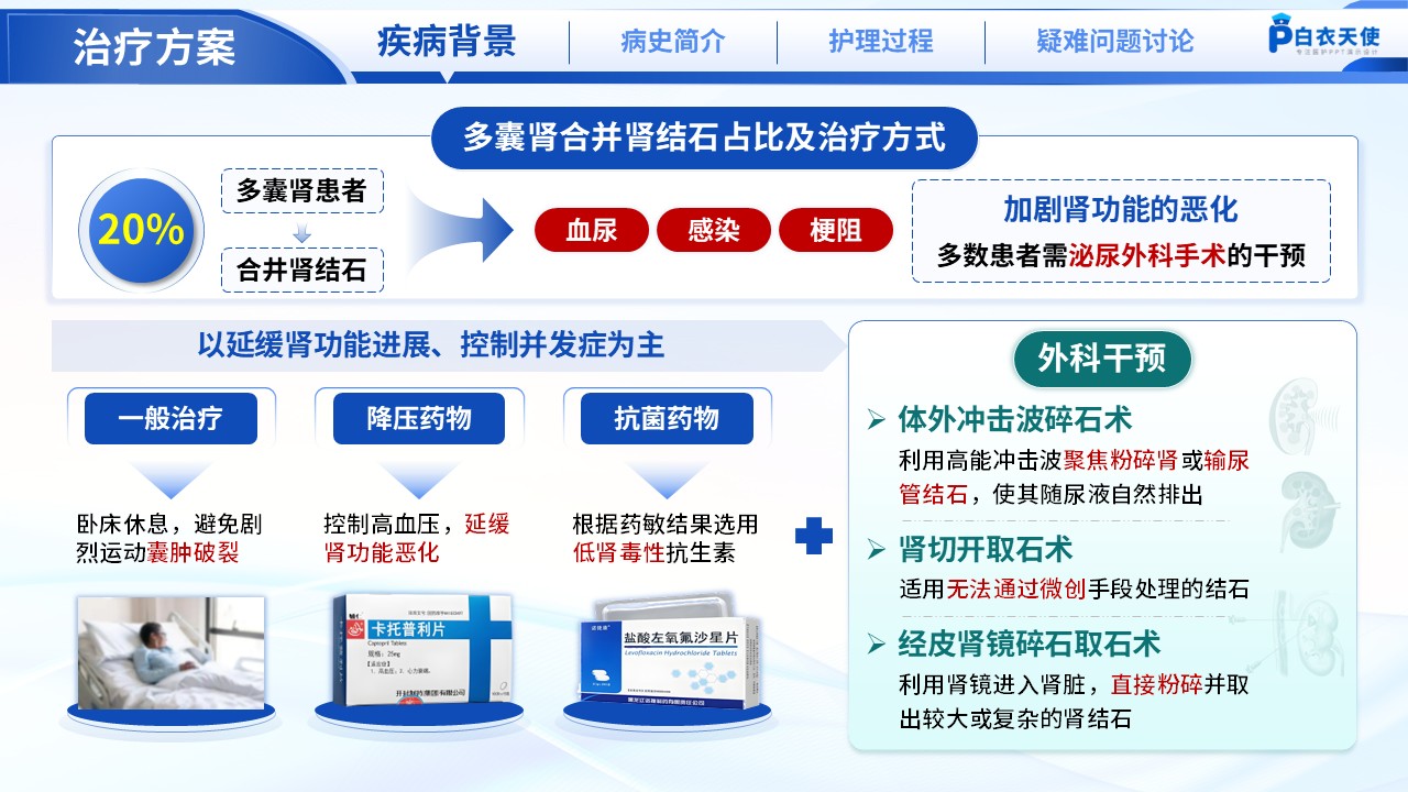 188期-疑难病例讨论-多囊肾合并肾结石第4页预览