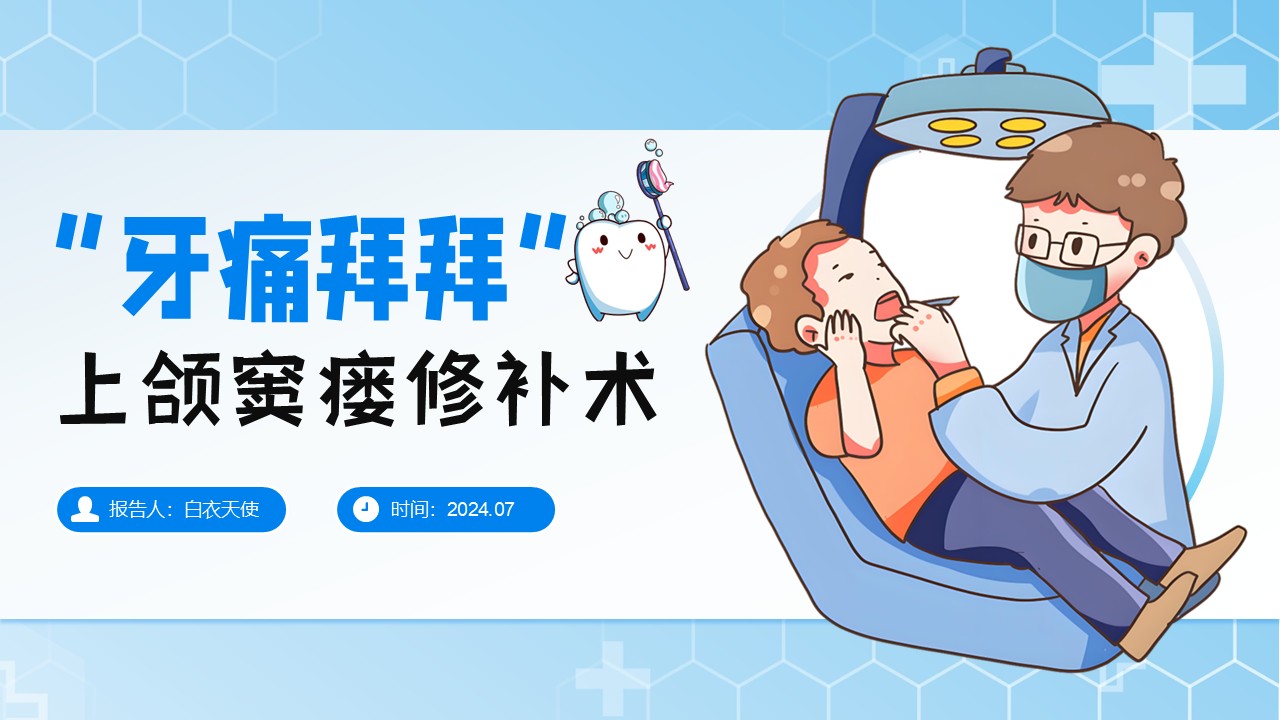 26-上颌窦瘘修补术