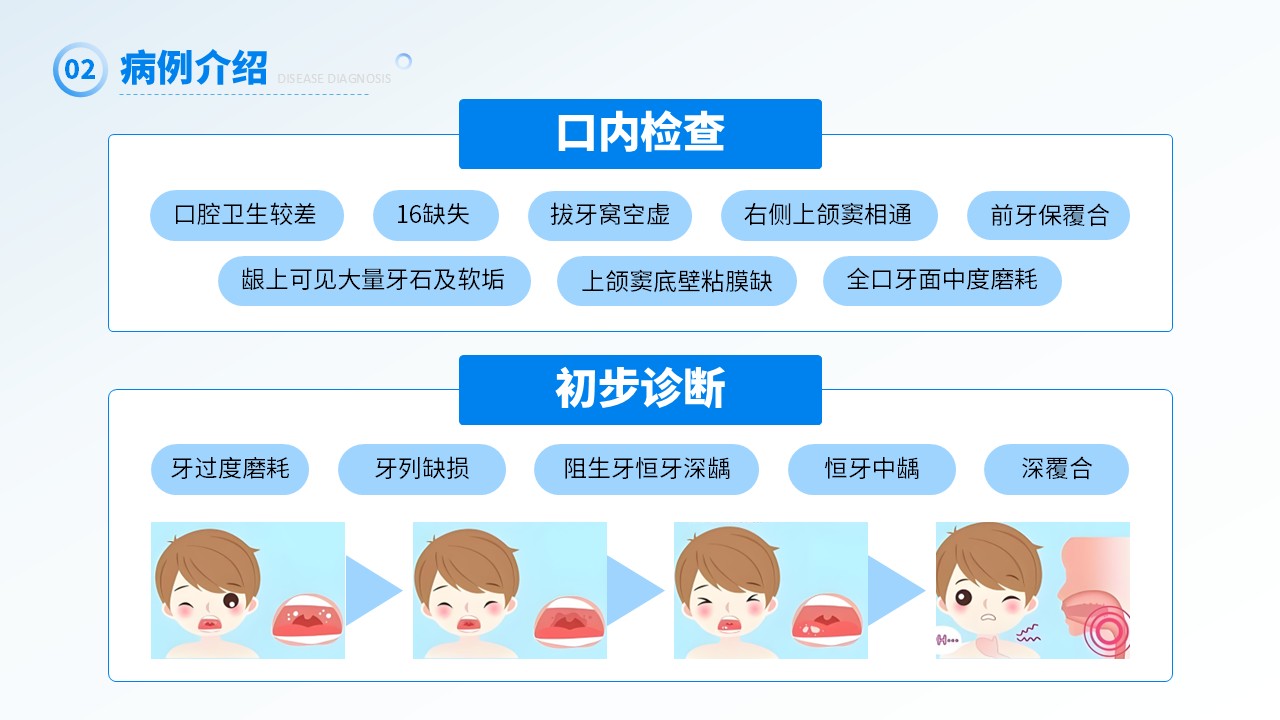 26-上颌窦瘘修补术第8页预览