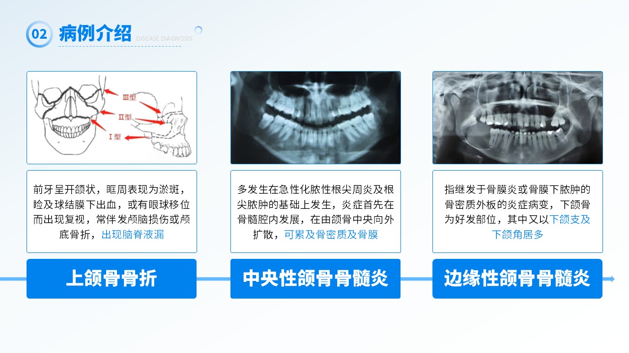 26-上颌窦瘘修补术第10页预览