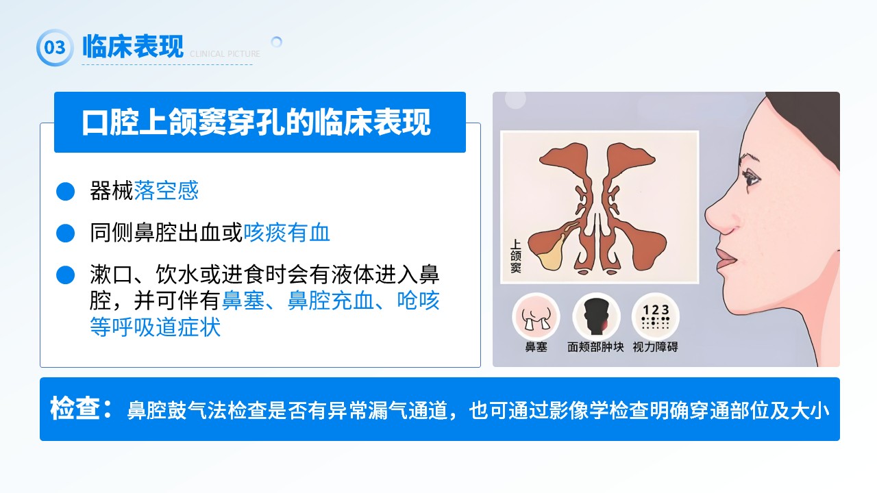 26-上颌窦瘘修补术第12页预览
