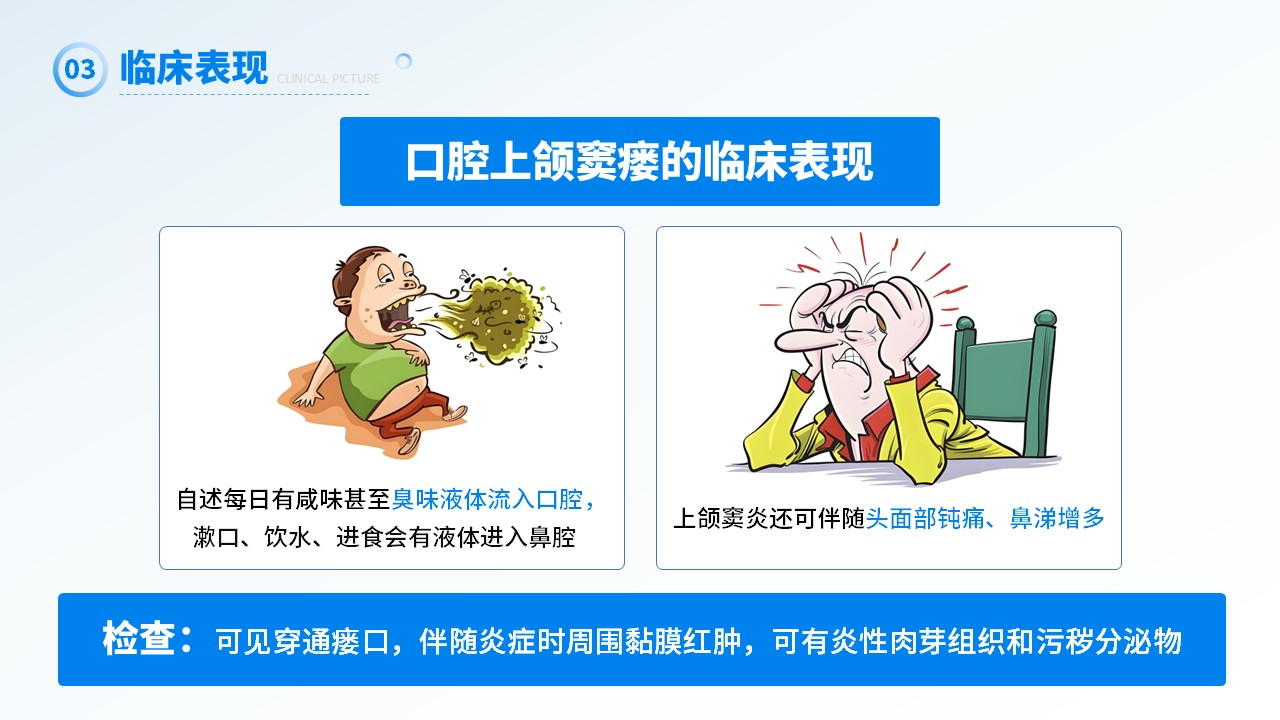 26-上颌窦瘘修补术第13页预览