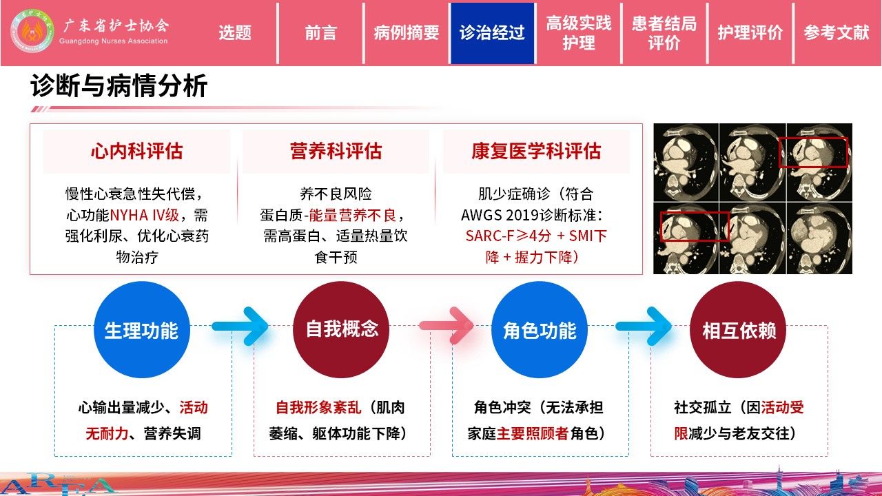 453期-护理个案-一例慢性心衰合并肌少症患者的个案照护第9页预览