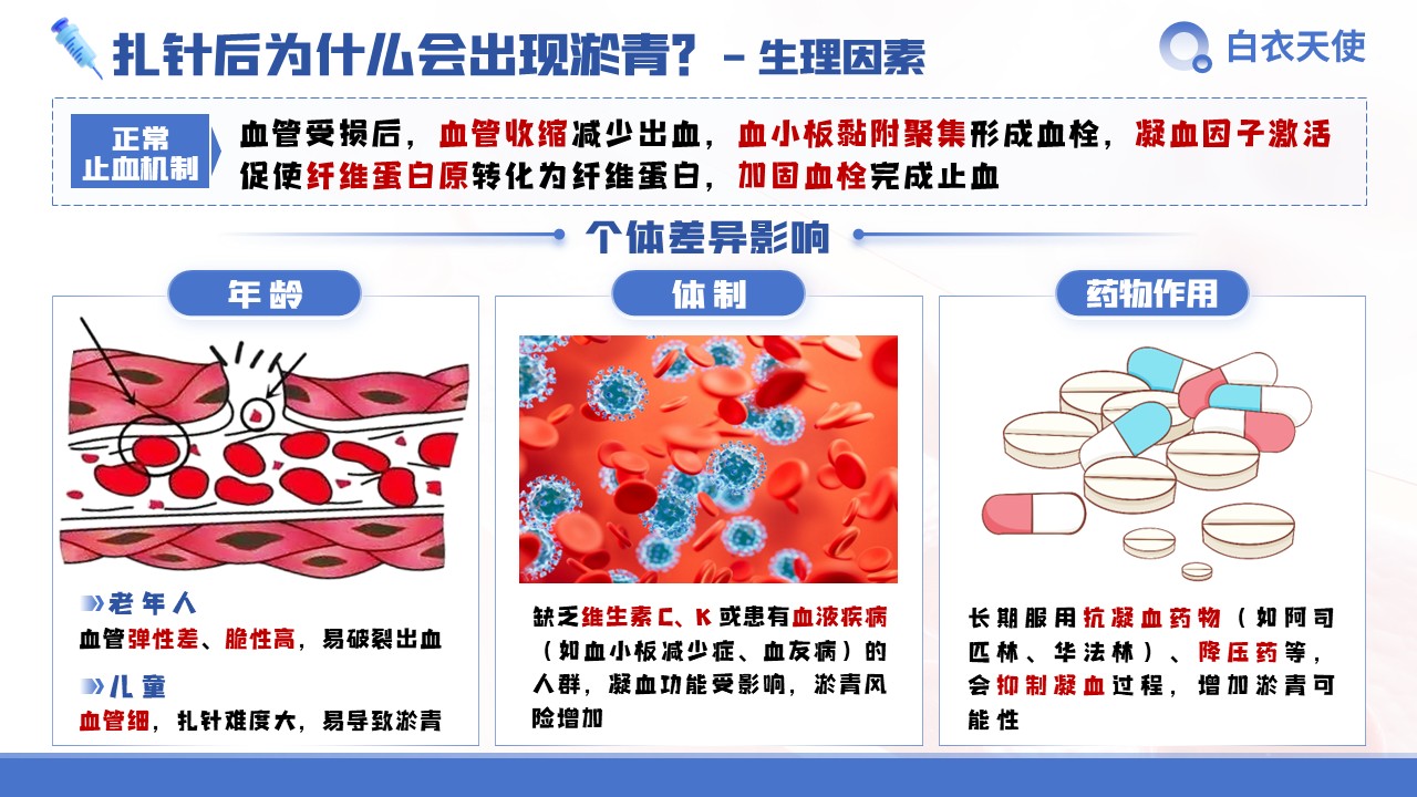 28-扎针后淤青健康宣教第4页预览