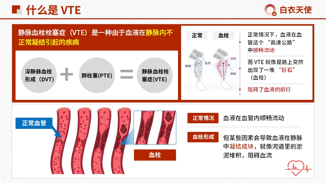 15-警惕 VTE健康宣教第3页预览