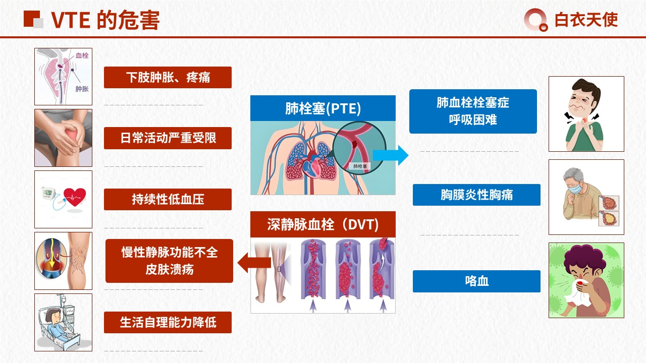 15-警惕 VTE健康宣教第4页预览
