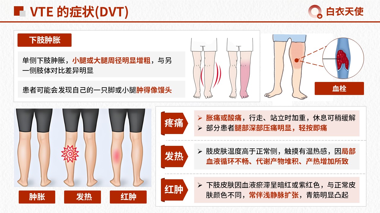 15-警惕 VTE健康宣教第6页预览