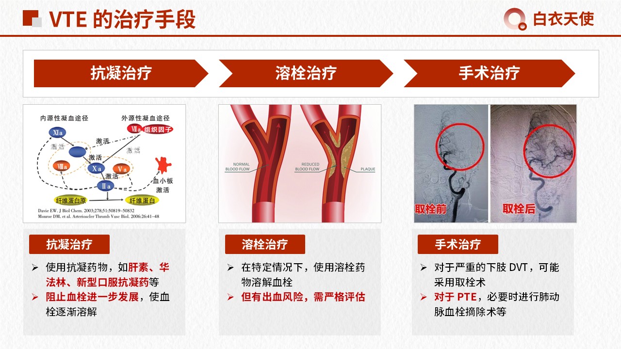 15-警惕 VTE健康宣教第9页预览