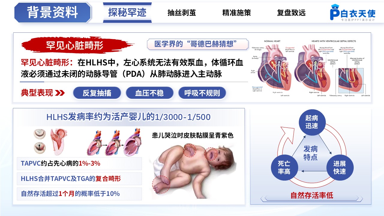 487期-疑难病例-一例罕见心脏畸形重症患者的MDT护理疑难病例讨论第3页预览