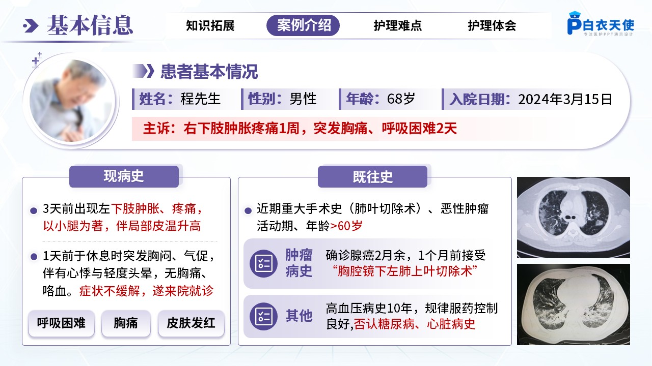 262期-疑难病例-一例静脉血栓栓塞症患者的疑难病例讨论第6页预览