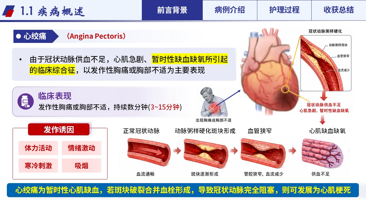 359期-护理个案-一例心绞痛合并高血压II级患者康复的个案护理第3页预览