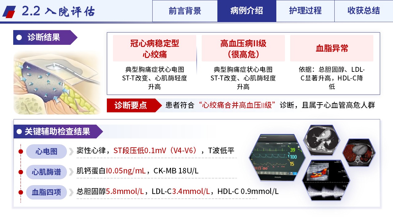 359期-护理个案-一例心绞痛合并高血压II级患者康复的个案护理第8页预览