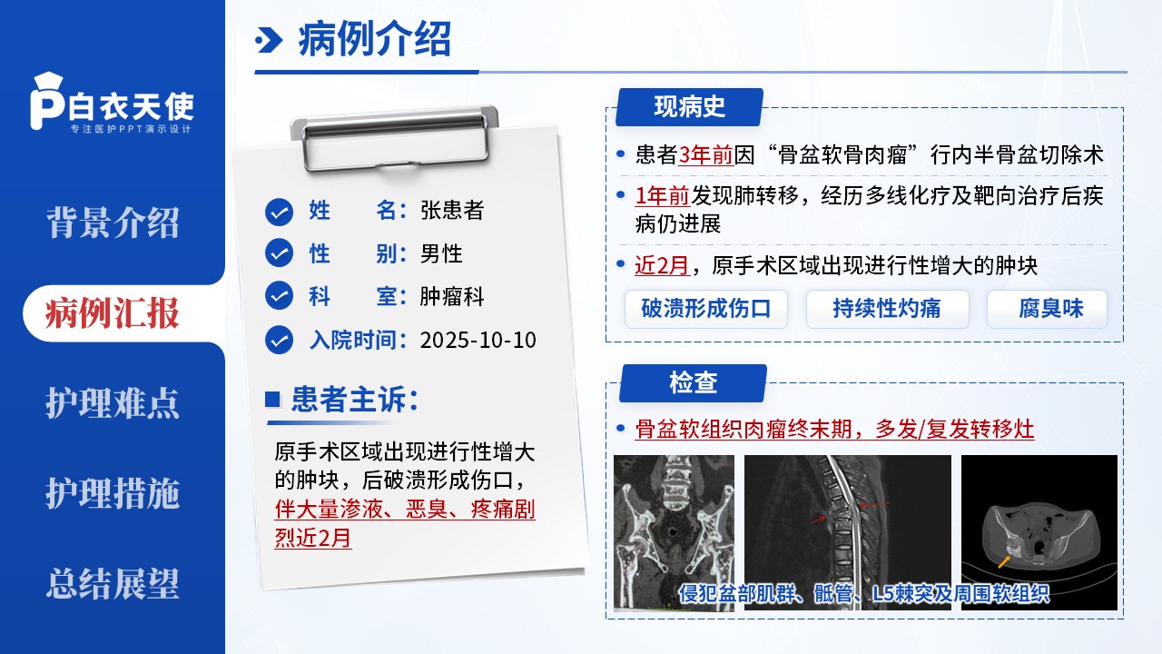 258期-疑难病例-1例骨盆恶性肿瘤终未期癌性伤口患者第5页预览
