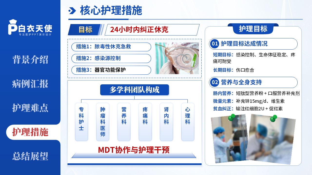 258期-疑难病例-1例骨盆恶性肿瘤终未期癌性伤口患者第11页预览