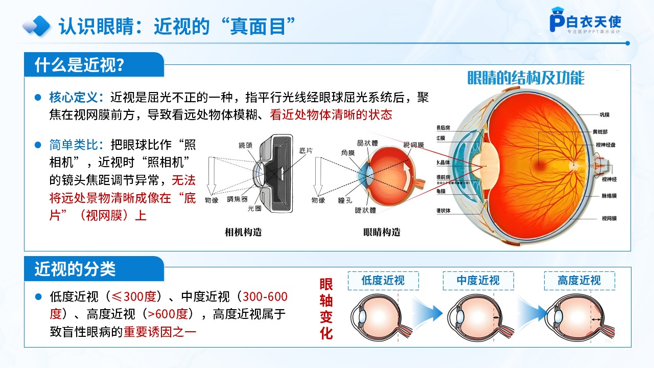 70-防近视及爱护眼睛医疗科普第4页预览