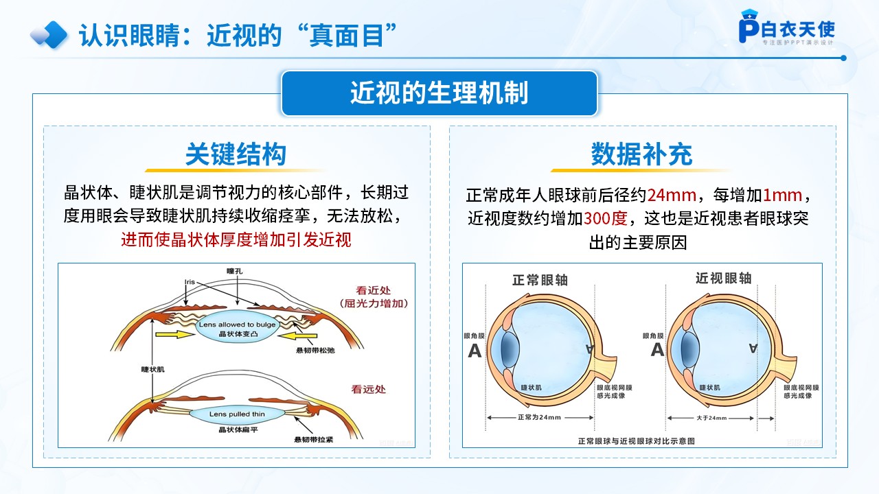 70-防近视及爱护眼睛医疗科普第5页预览