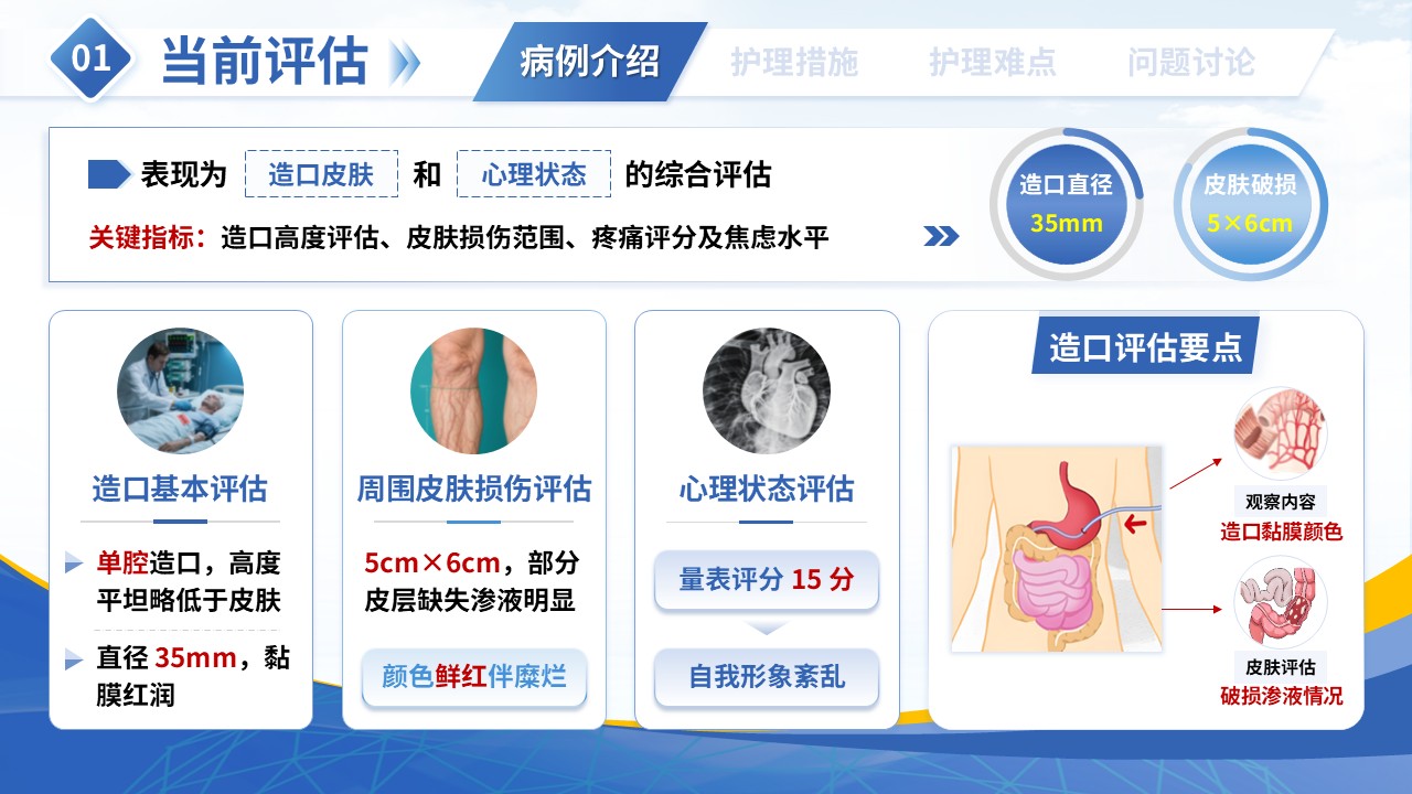 343期-疑难病例讨论-一例结直肠癌术后患者护理实践第6页预览