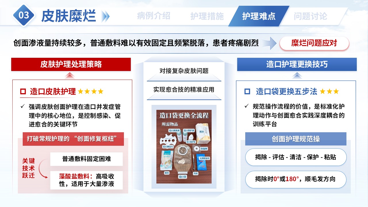 343期-疑难病例讨论-一例结直肠癌术后患者护理实践第13页预览