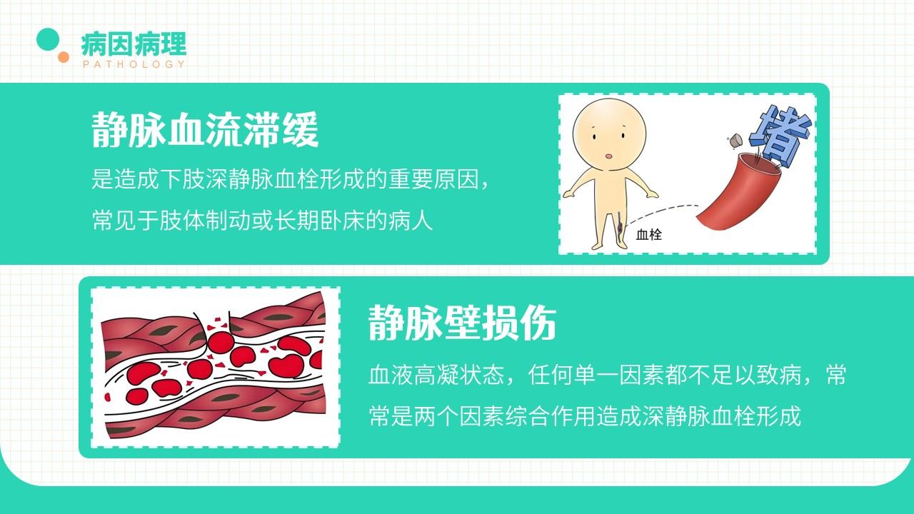 20-长期卧床患者下肢深静脉血栓的评估及预防策略第8页预览